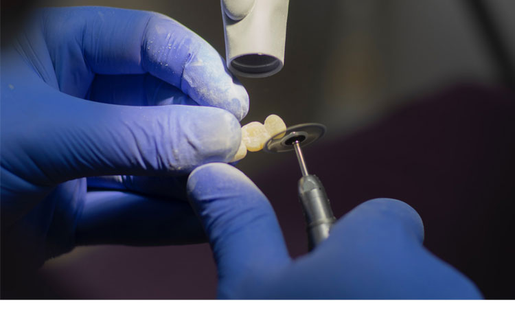 Hybrid ceramic bearings in dental instruments: the benefits